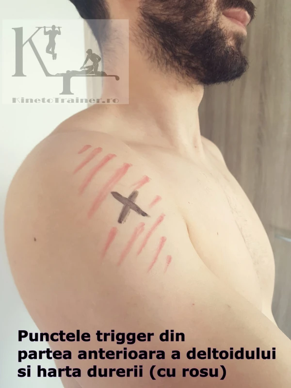 puncte trigger partea anterioara