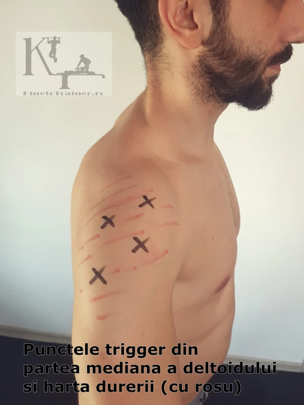 puncte trigger partea mediana